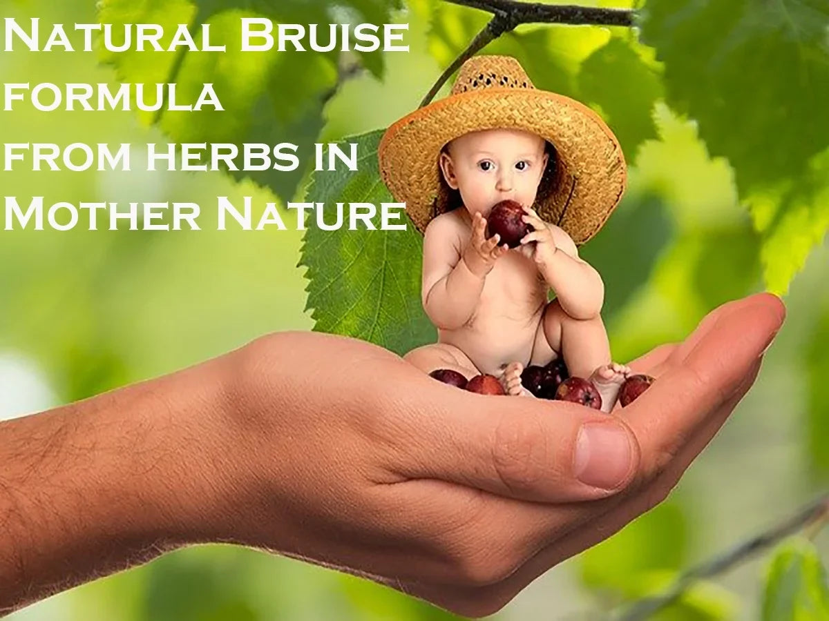 bruise NO bruise pack- ONE 3 WEEK, by Natural BruiseGONE CREAM, remedy healing Speeds
